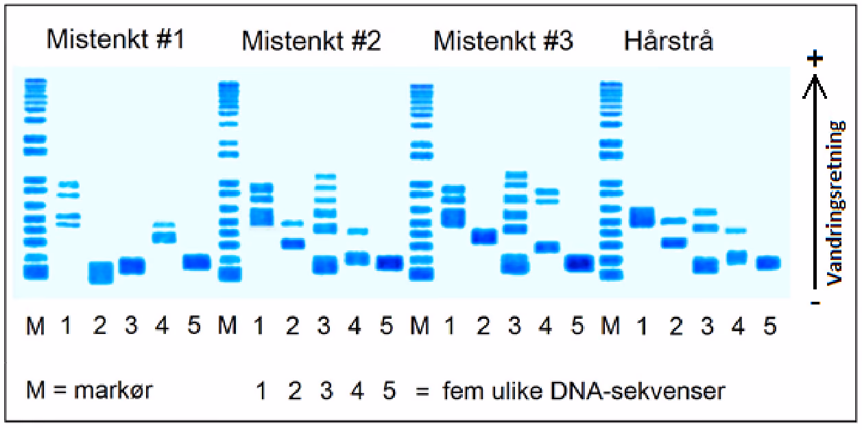 Gelelektroforese med DNA-profilene til mistenkt 1, 2 og 3 og hårstrået. Hver profil har en markør (M) og fem ulike DNA-sekvenser (1–5). Vandringsretningen er fra – til +