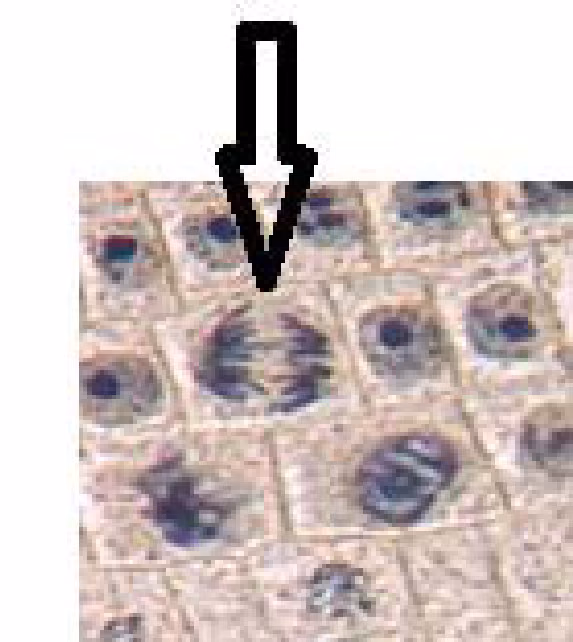 Mikroskopbilde av løkceller fra delingssonen i rota, med en pil som peker på én celle